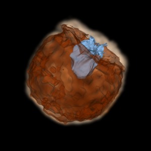 Supernovae1a